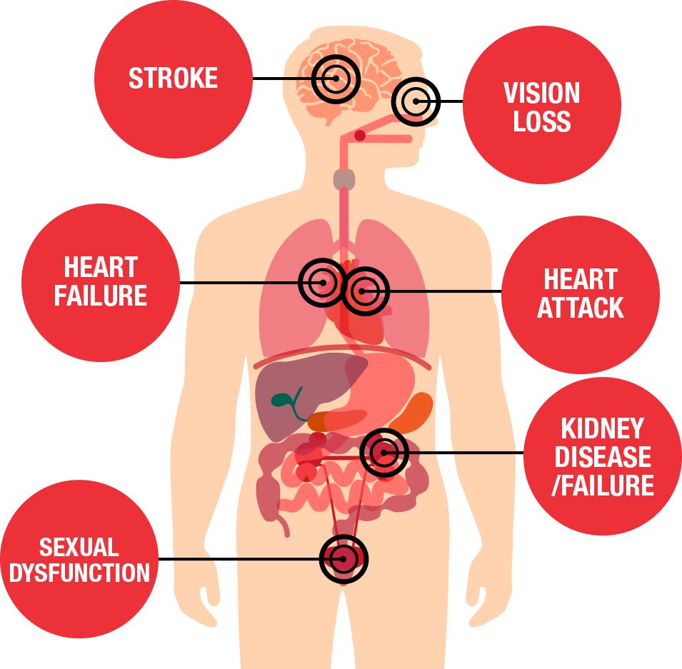 2 image2 Health threats diagram UCM 489361 روز جهانی فشار خون