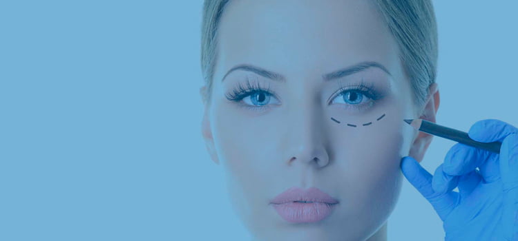 بلفاروپلاستی چیست؟ 1 Blepharoplasty