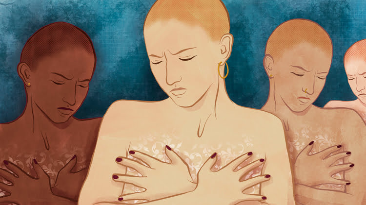 ماستکتومی و انواع آن 1 mastectomy ماستکتومی و انواع آن