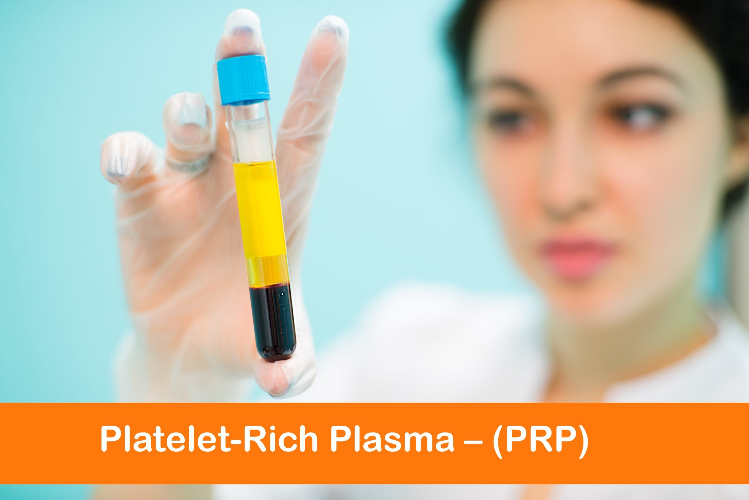 درمان با پلاسمای غنی از پلاکت 1 platelet rich plasma
