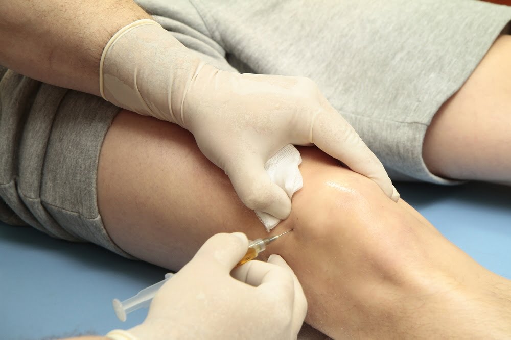 prp knee injection پلاسمای غنی از پلاکت