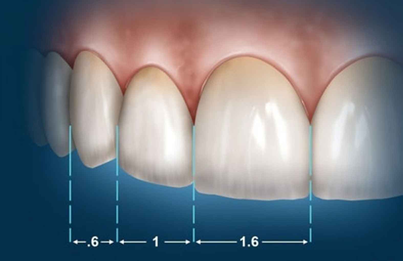 نسبت طلایی در دندان ها 1 زیبایی و نسبت طلایی