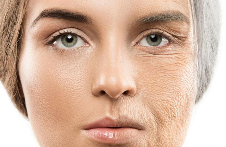 پیری زودرس و نشانه های آن 1 پیری زودرس