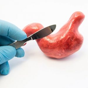 هامون مدیکال | گن لاغری و بعد عمل فاجات 17 رایج ترین عمل های جراحی چاقی