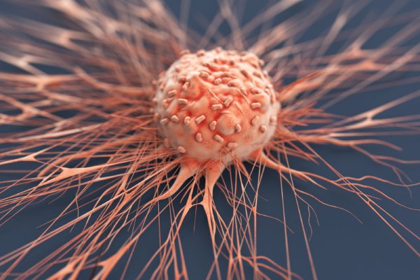 cancer cells راه های درمان سرطان سینه